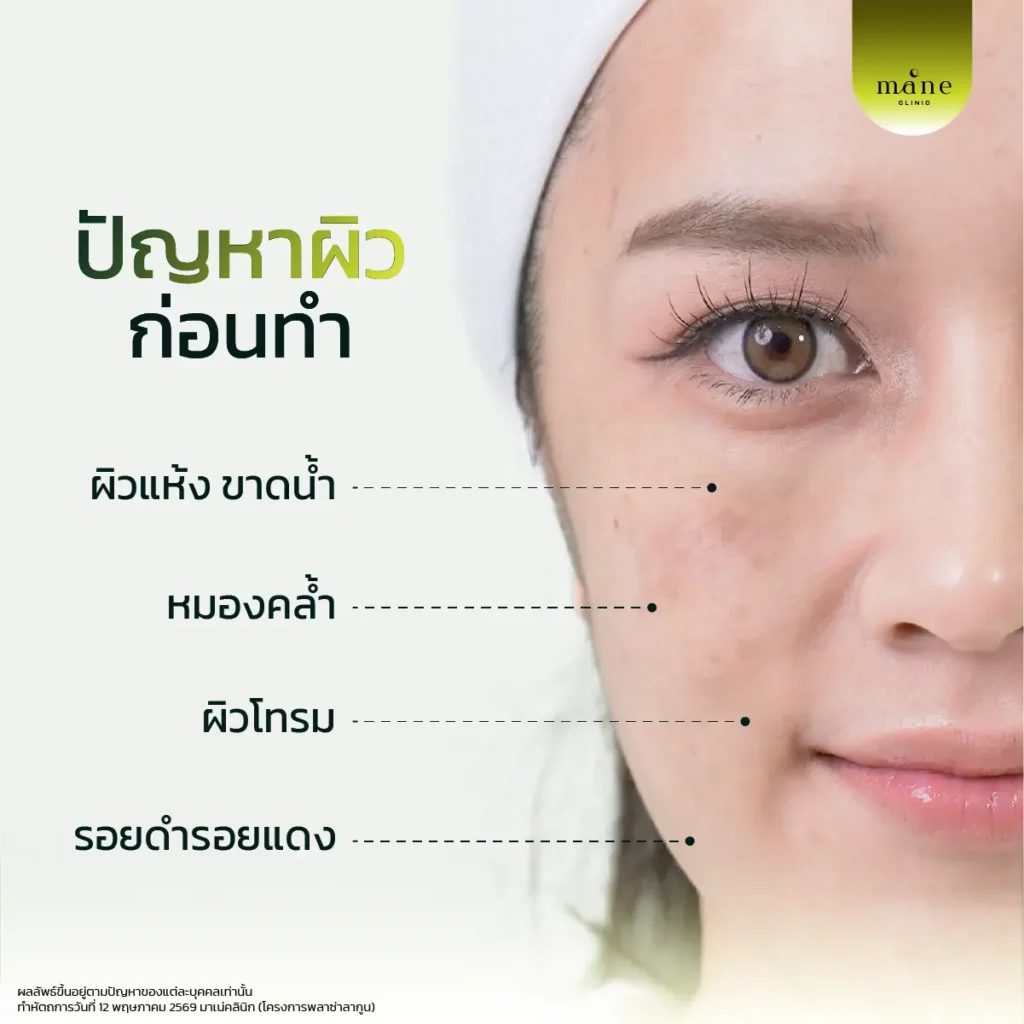 ปัญหาผิวก่อนทำ