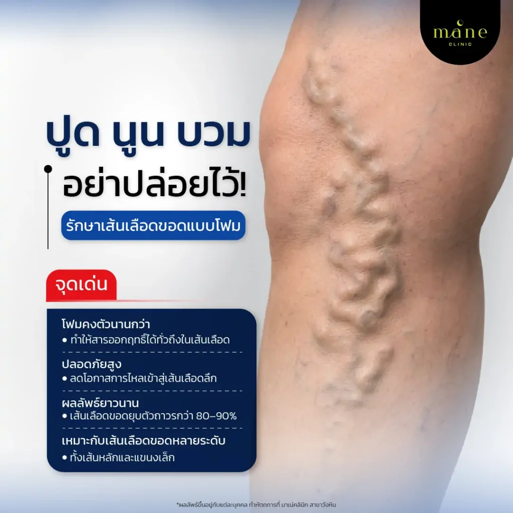ปูม นูน บวม อย่าปล่อยไว้