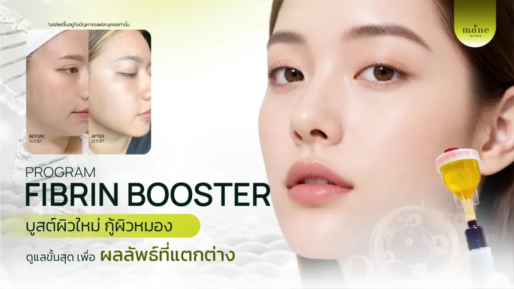 Growth Factors