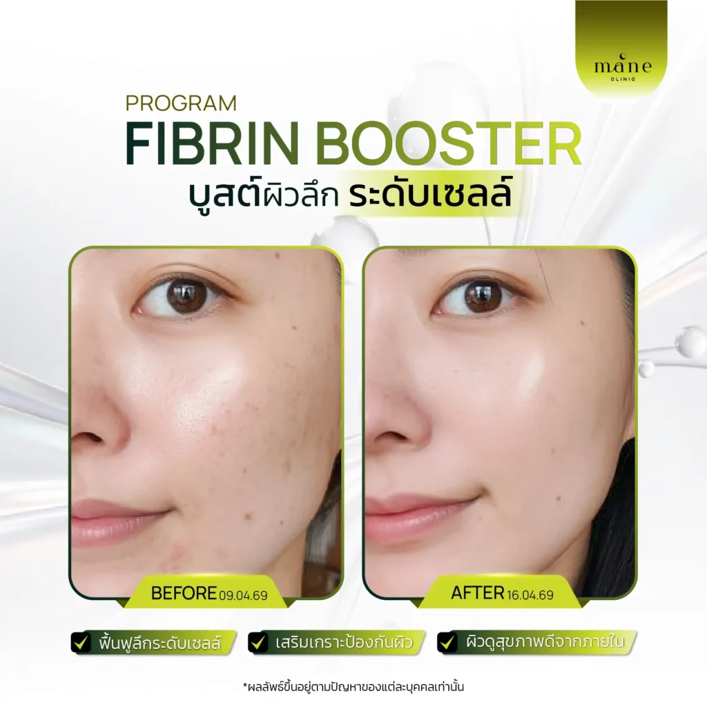 fibrin booster บูสต์ผิวระดับเซลล์