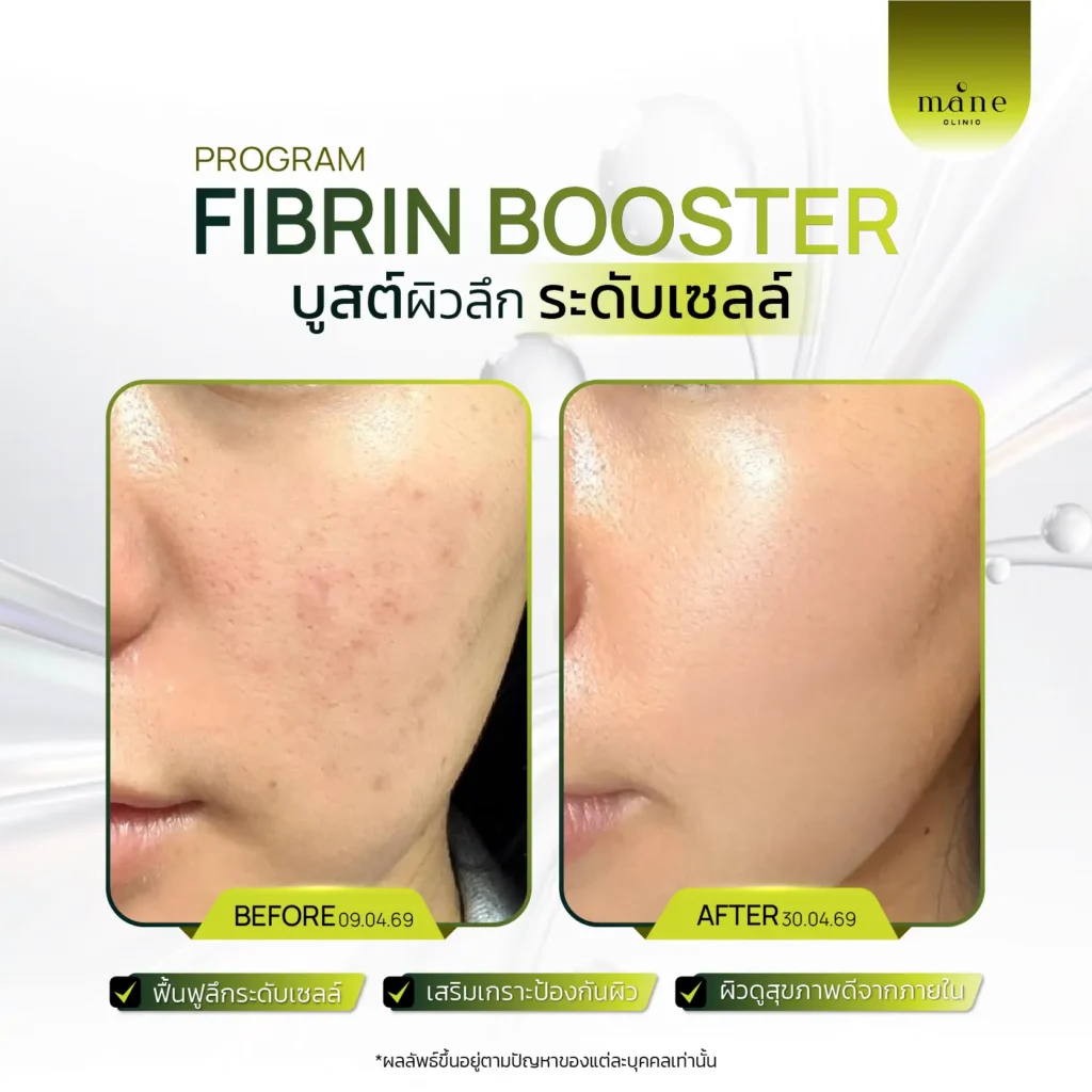 fibrin booster บูสต์ผิวระดับเซลล์
