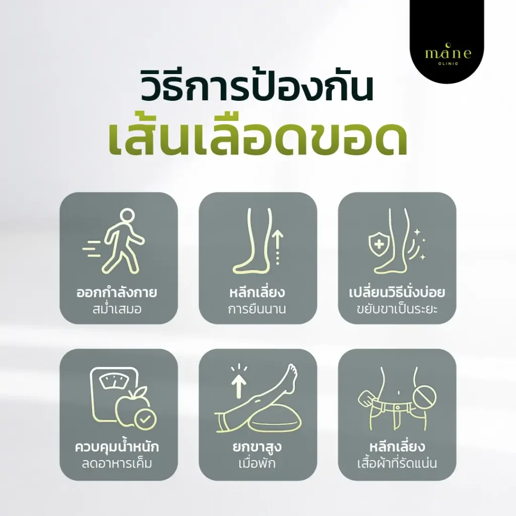 วิธีการป้องกันเส้นเลือดขอด