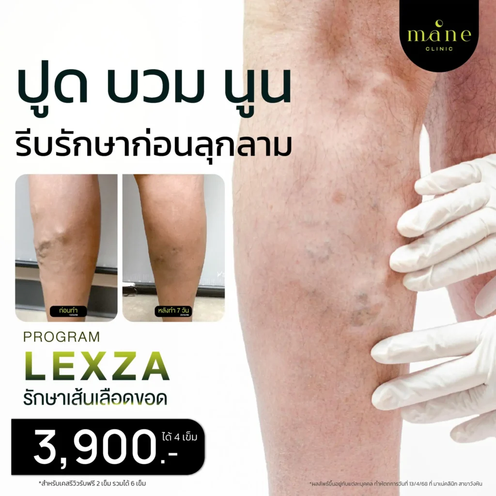 ปูด บวม นูน
