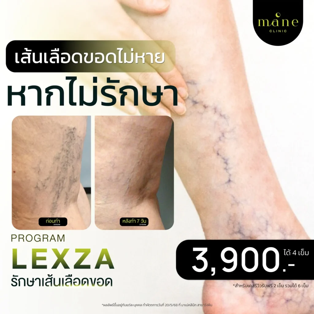 หากไม่รักษา