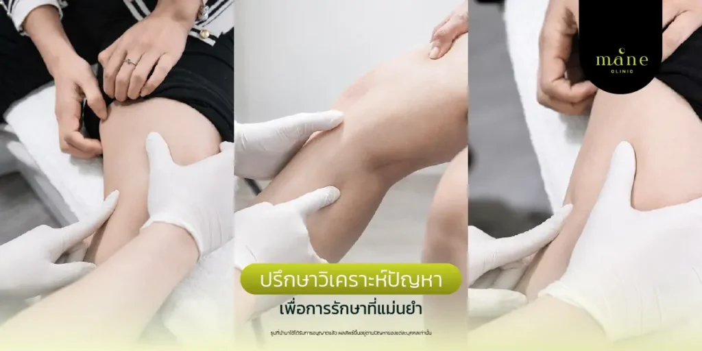 ปรึกษาวิเคราะห์ปัญหา
