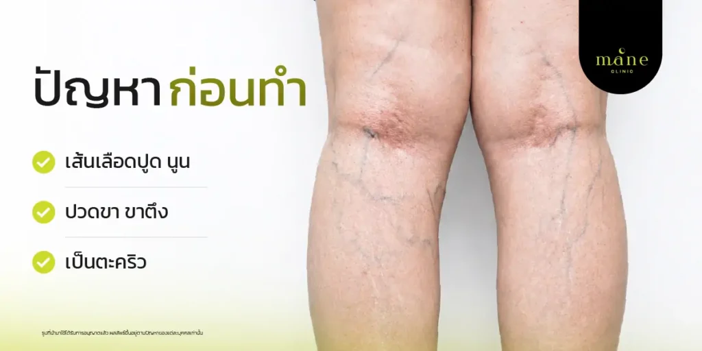 ปัญหาก่อนทำ