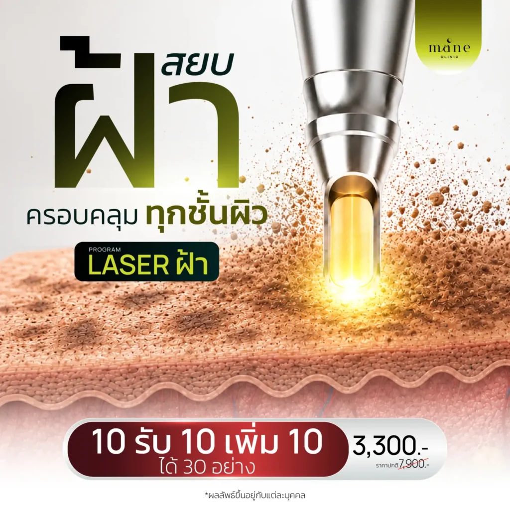 สยบฝ้า