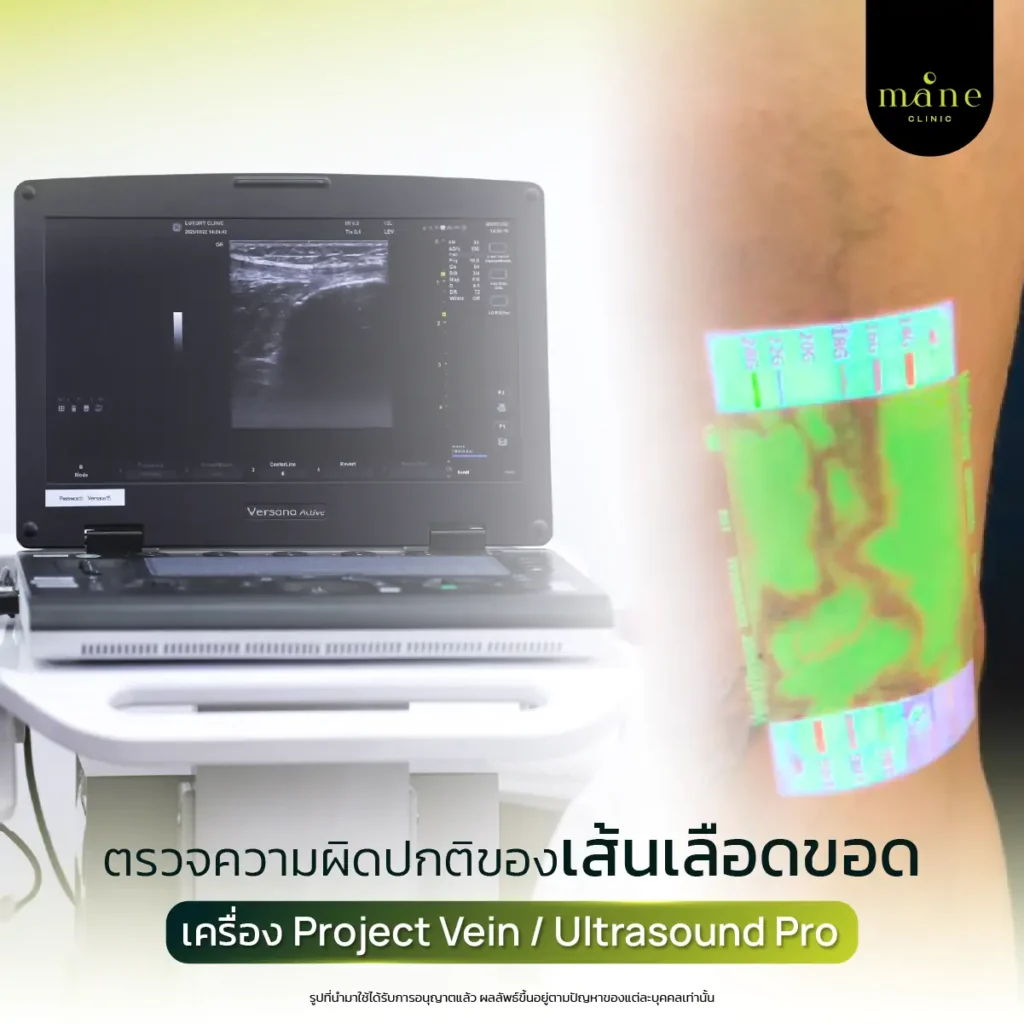 ตรวจความผิดปกติของเส้นเลือดขอด