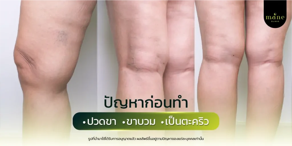ปัญหาก่อนทำ