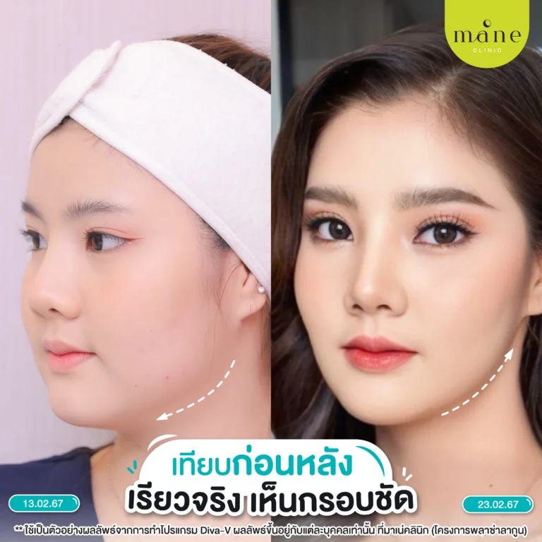 รีวิว diva v