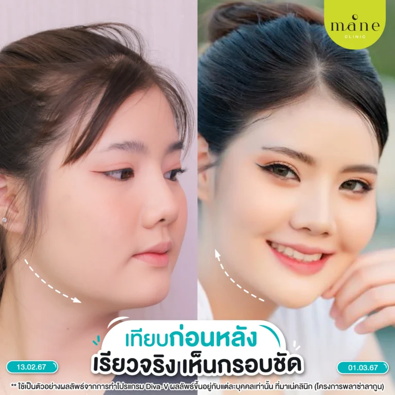 รีวิว diva v