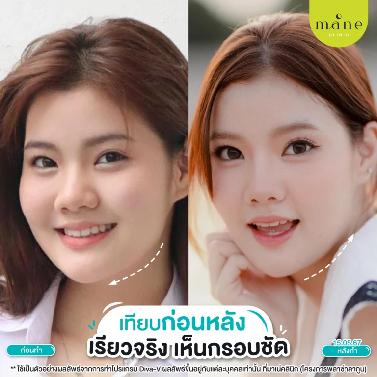 รีวิว diva v
