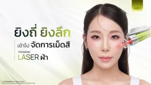 ยิงถี่ ยิงลึก laser ฝ้า