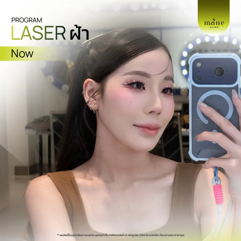 Laser ฝ้าที ่ Mane Clinic ตอบโจทย์มากค่ะ