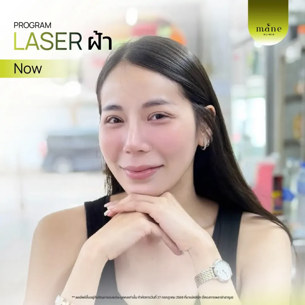 Laser ฝ้าที ่ Mane Clinic ตอบโจทย์มากค่ะ