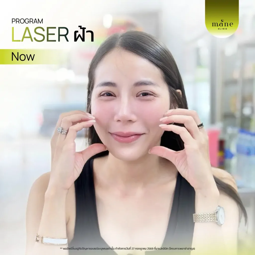 Laser ฝ้าที ่ Mane Clinic ตอบโจทย์มากค่ะ