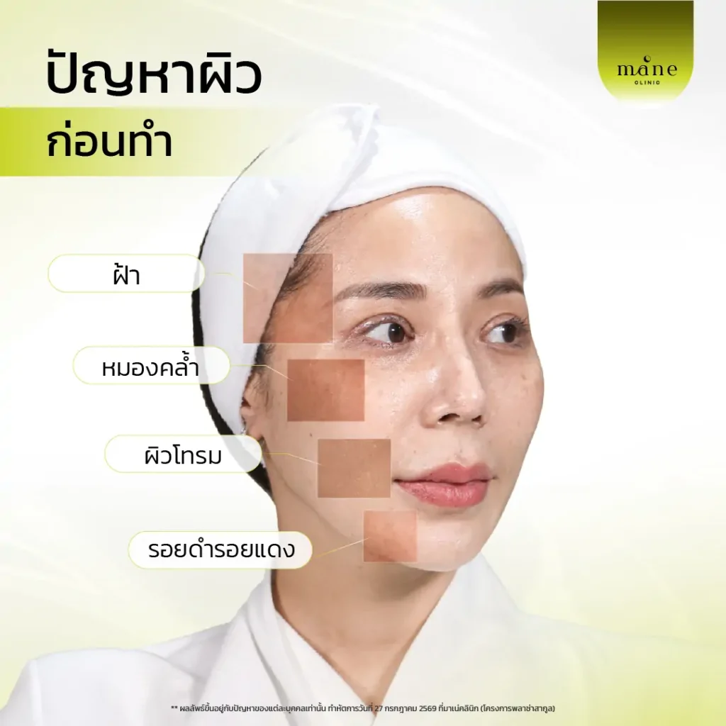 ปัญหาผิวก่อนทำ